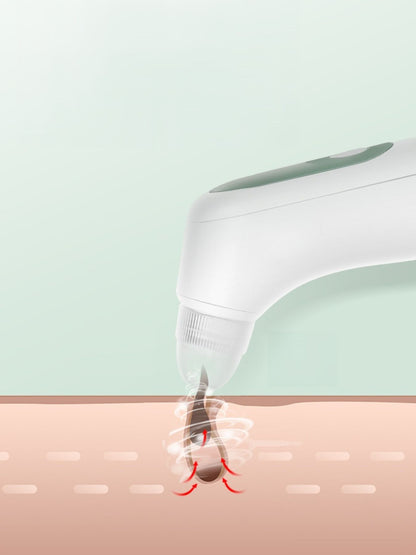 White painless pore vacuum blackhead extractor from Trendsi, with a sleek design for facial pore cleansing and blackhead removal.
